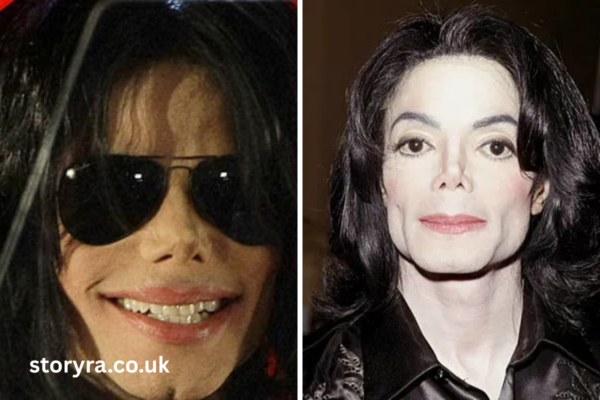 how did michael jackson die